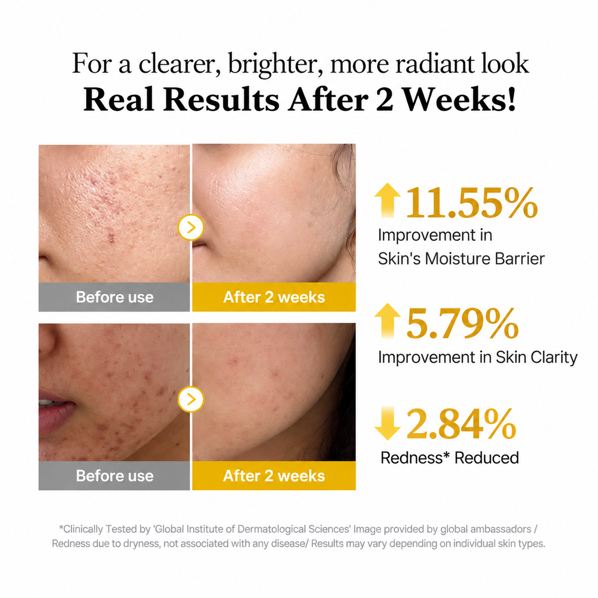 Kojic Acid Turmeric Niacinamide Serum - Medicube