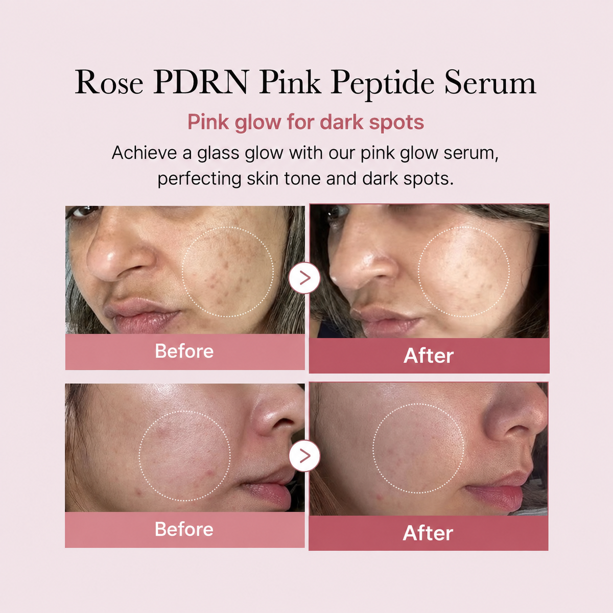 PDRN Pink Peptide Serum - Medicube